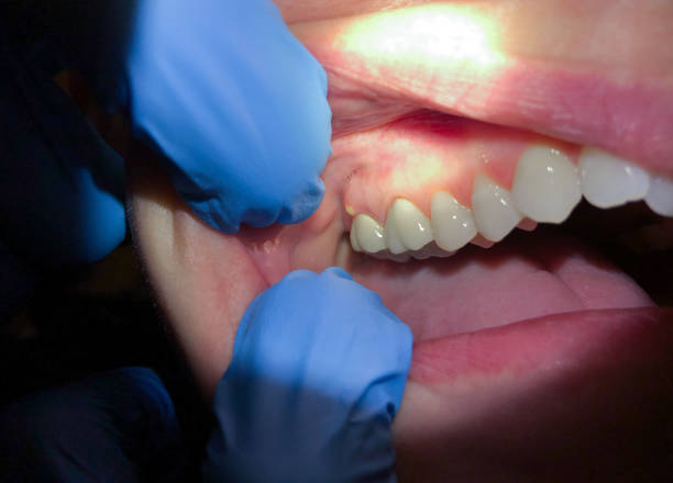 Best Walk-In Emergency Dentist in Northwest Harwich, MA